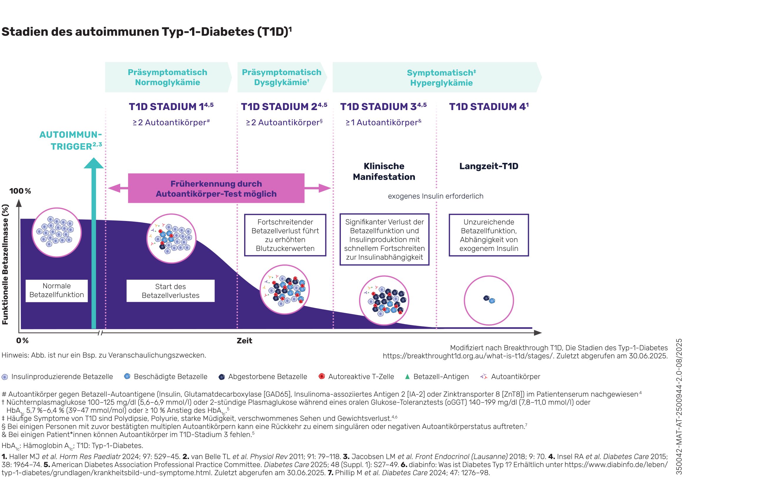 Infografik zu den Stadien des autoimmunen Typ-1-Diabetes (T1D). Die Grafik zeigt vier Stadien in chronologischer Abfolge: Stadium 1 (präsymptomatische Normoglykämie mit ≥2 Autoantikörpern), Stadium 2 (präsymptomatische Dysglykämie mit ≥2 Autoantikörpern), Stadium 3 (symptomatische Hyperglykämie mit ≥1 Autoantikörper) und Stadium 4 (klinische Symptome). Dargestellt wird der progressive Verlust der Betazellfunktion von 100% auf 0% über die Zeit, ausgelöst durch einen Autoimmun-Trigger. Die Grafik veranschaulicht verschiedene Zelltypen: insulinproduzierende Betazellen (blau-rot), beschädigte Betazellen (schwarz), abgestorbene Betazellen (grau), autoreaktive T-Zellen (rot) und Betazell-Antigene (grün). Zusätzlich werden klinische Symptome wie Polydipsie, Polyurie, Müdigkeit, verschwommenes Sehen und Gewichtsverlust aufgeführt.