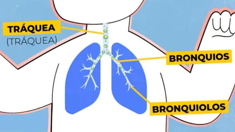 serie de imágenes explicando como el virus afecta los pulmones. El VSR se propaga rapidamente en el tracto respiratorio