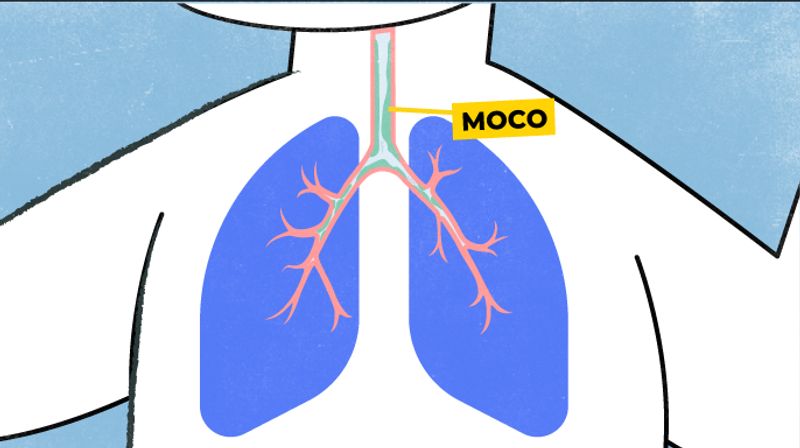 imágenes explicando como el virus afecta los pulmones. Los síntomas se pueden agravar por disfunción o inflamación y acumulación excesiva de moco.