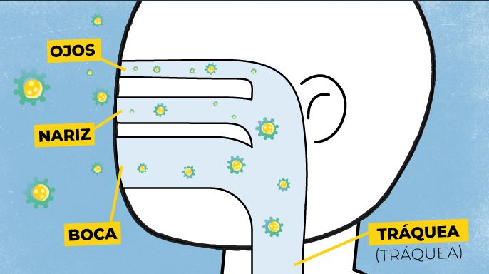 serie de imágenes explicando como el virus afecta los pulmones. 1, el VSR ingresa al cuerpo del bebé