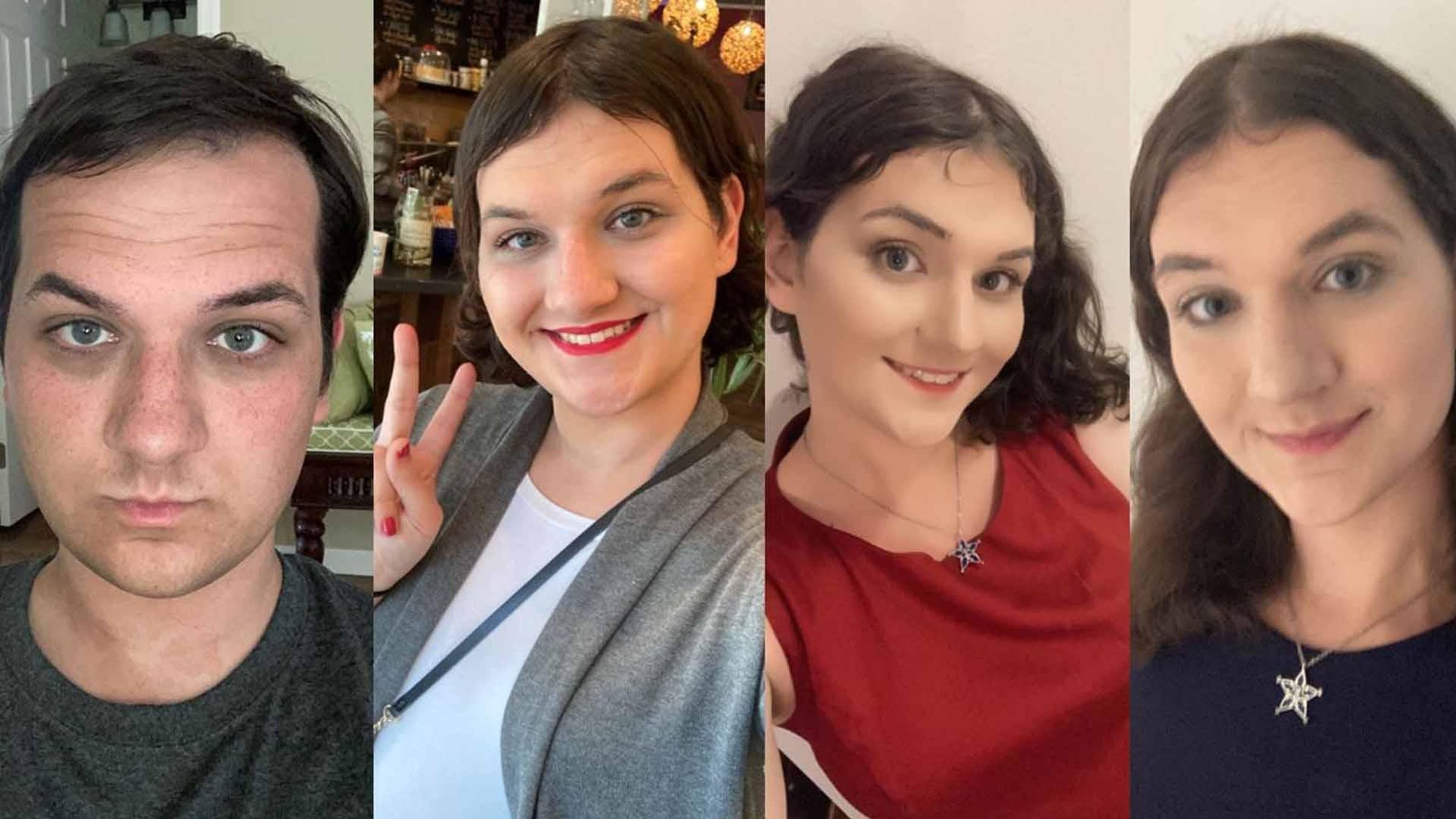 Amelia throughout her transition; pictures taken every 6 months