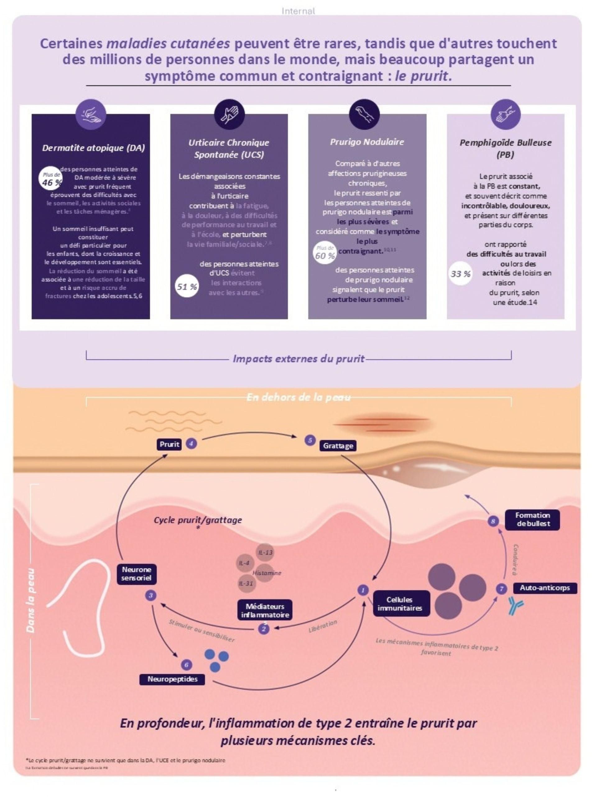 Une infographie présentant les répercussions sur les patients et les processus biologiques sous-jacents du prurit dans quatre maladies cutanées chroniques.